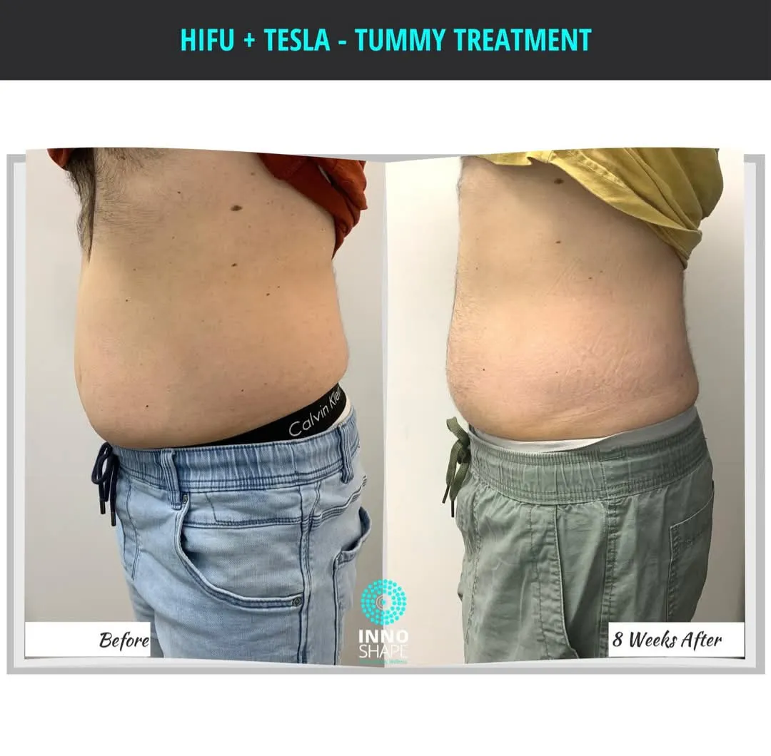 fb_img_1742537236175